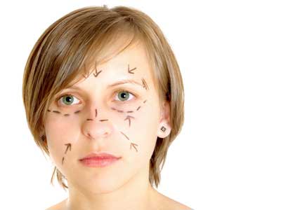 Facelift Minden